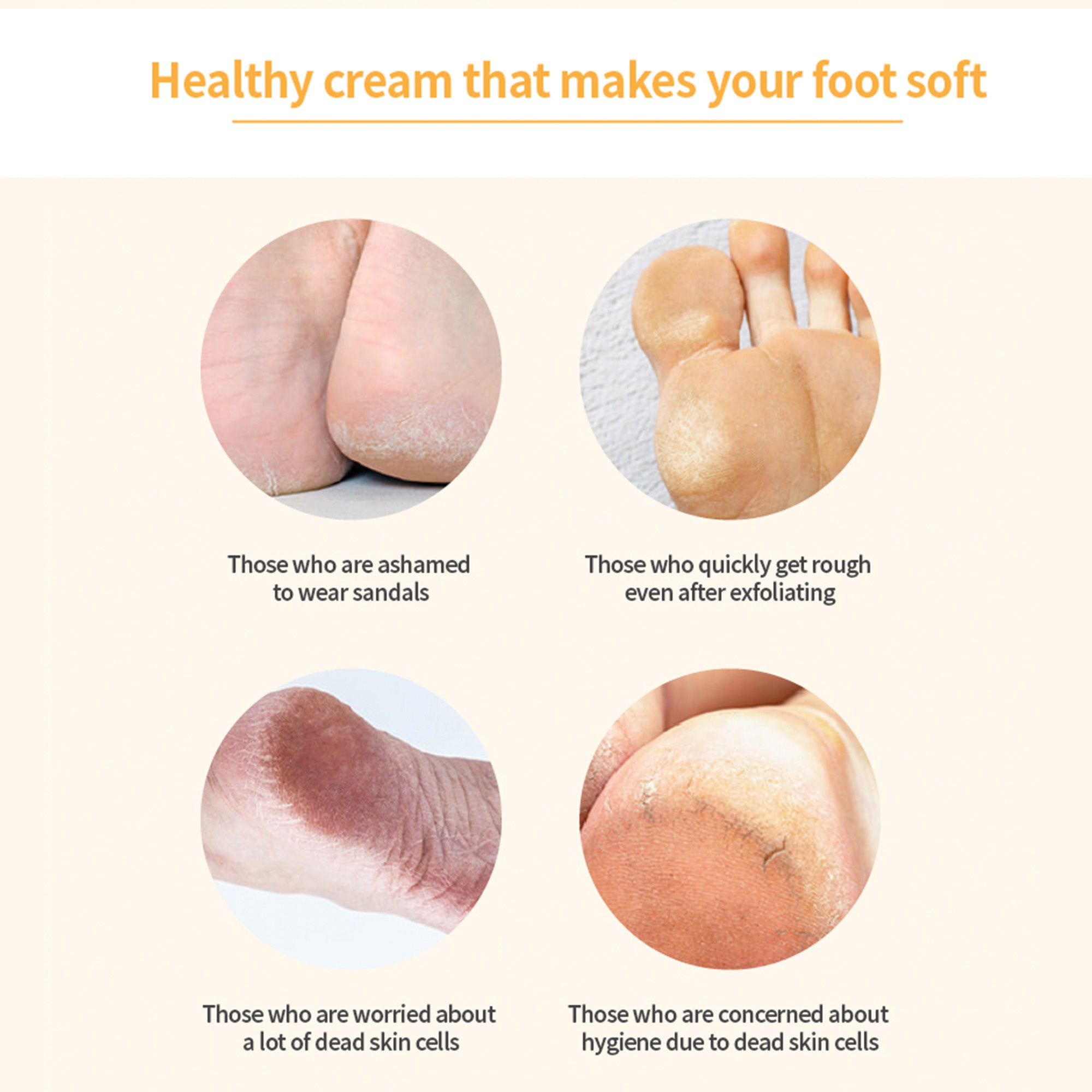 Luxury Foot Cream – Intensive Urea & Propolis Repair for Cracked Heels, Dry Calluses, and Peeling Skin