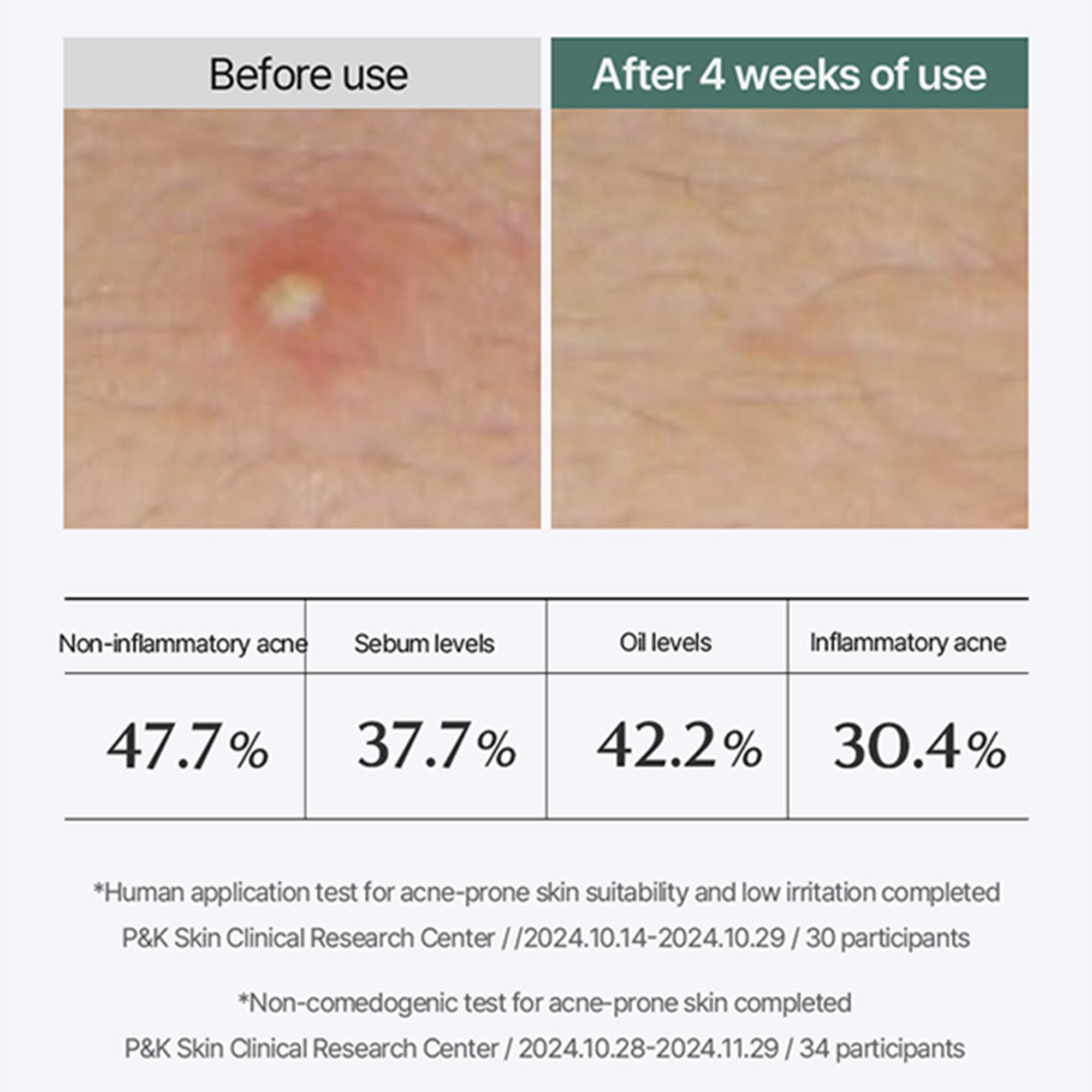 Cica Repair Panthenol Gel Mask – Cooling Soothing Mask for Redness, Irritation & Hydration Boost