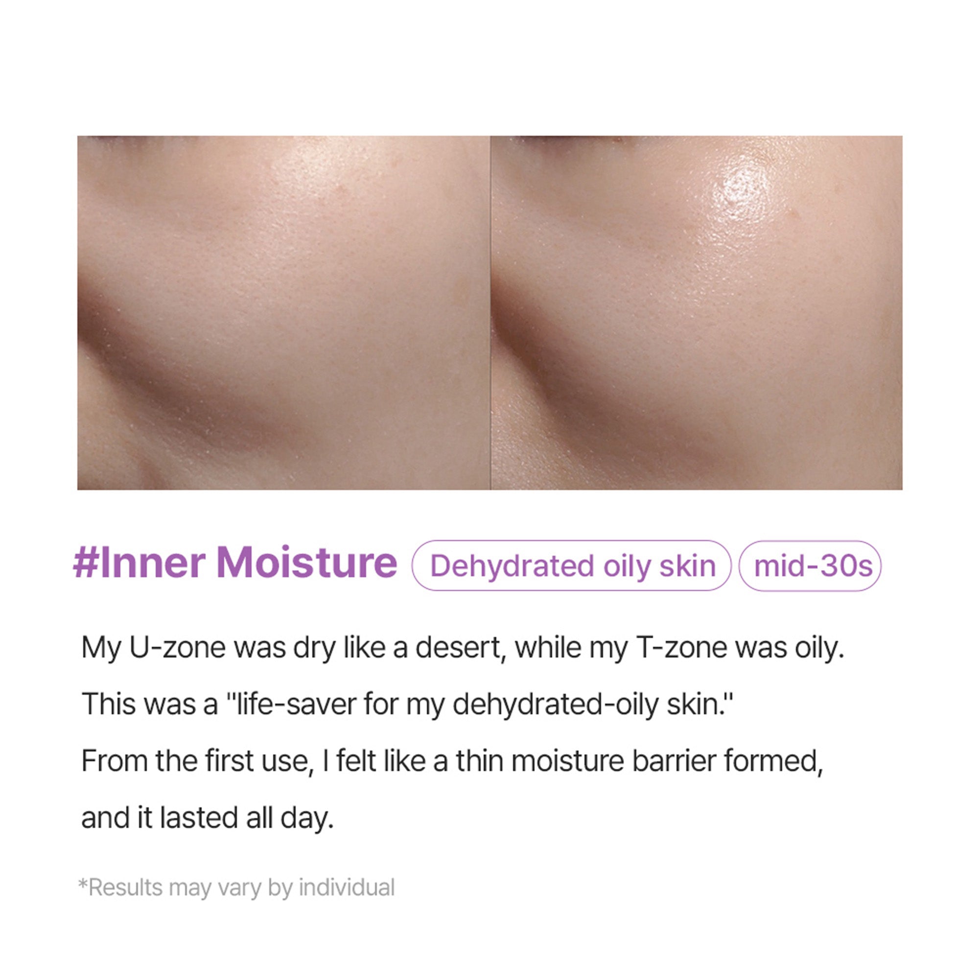 Super Collagen Booster Bubble Serum – Visible Firmness & Glow in 2 Weeks