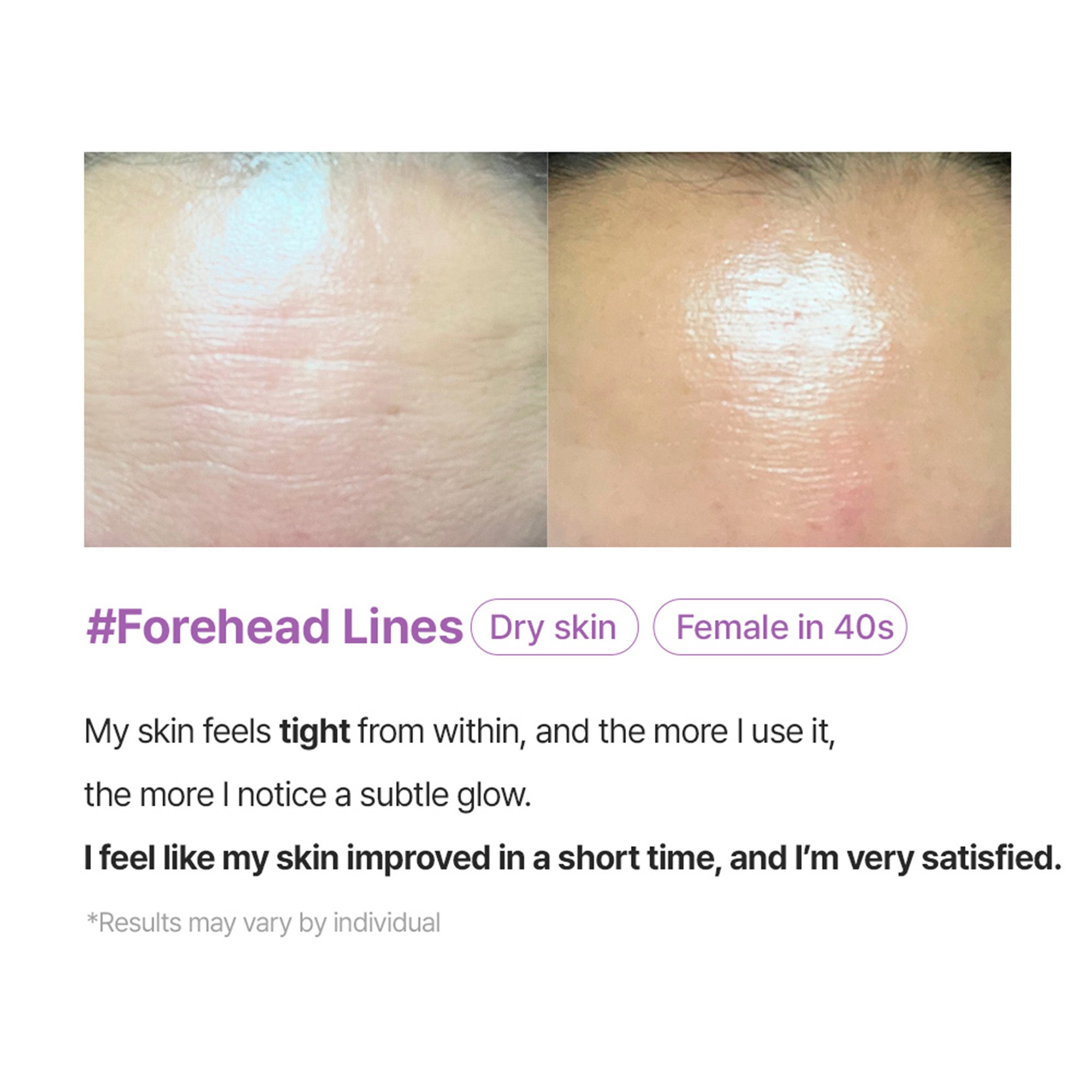 Super Collagen Booster Bubble Serum – Visible Firmness & Glow in 2 Weeks