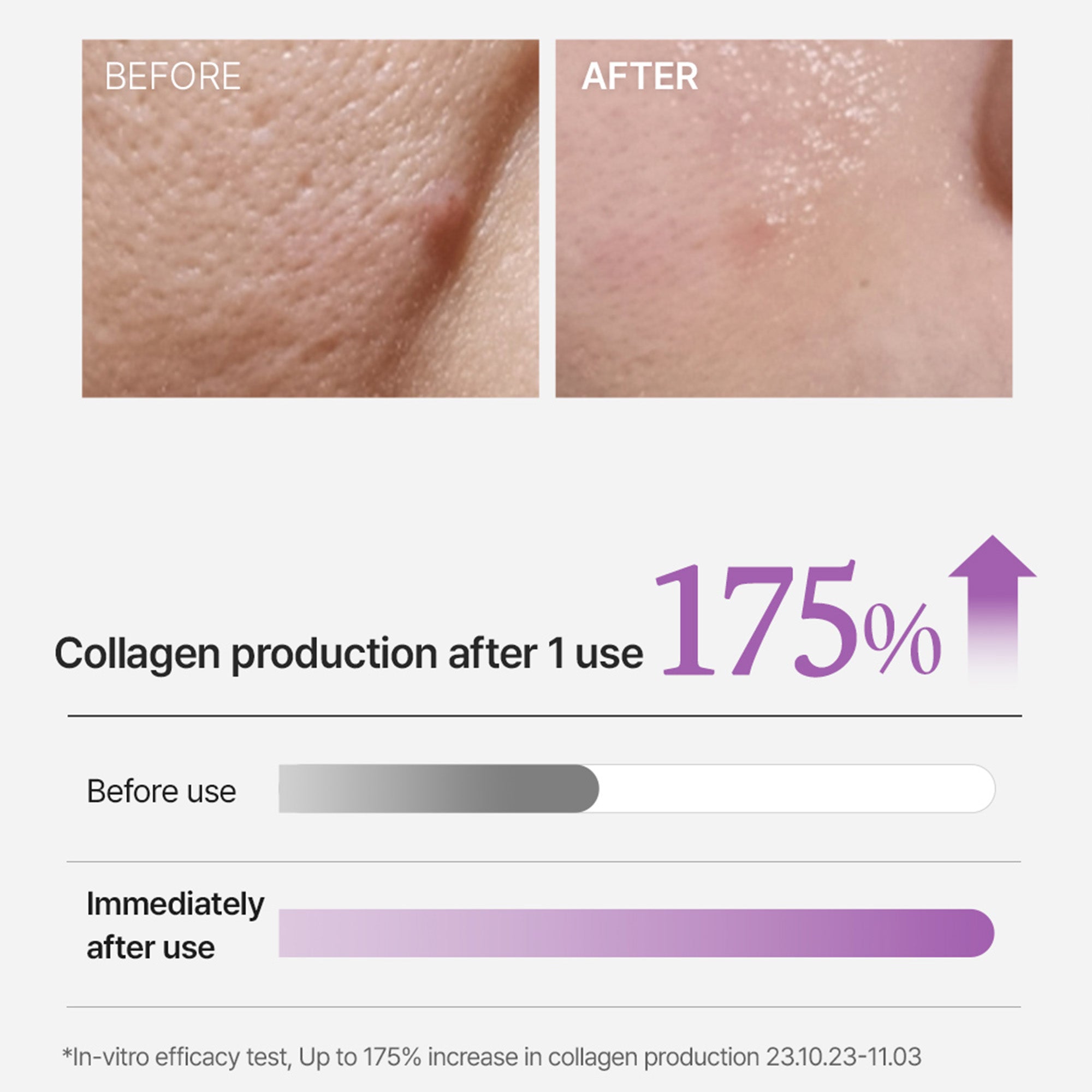 Super Collagen Booster Bubble Serum – Visible Firmness & Glow in 2 Weeks