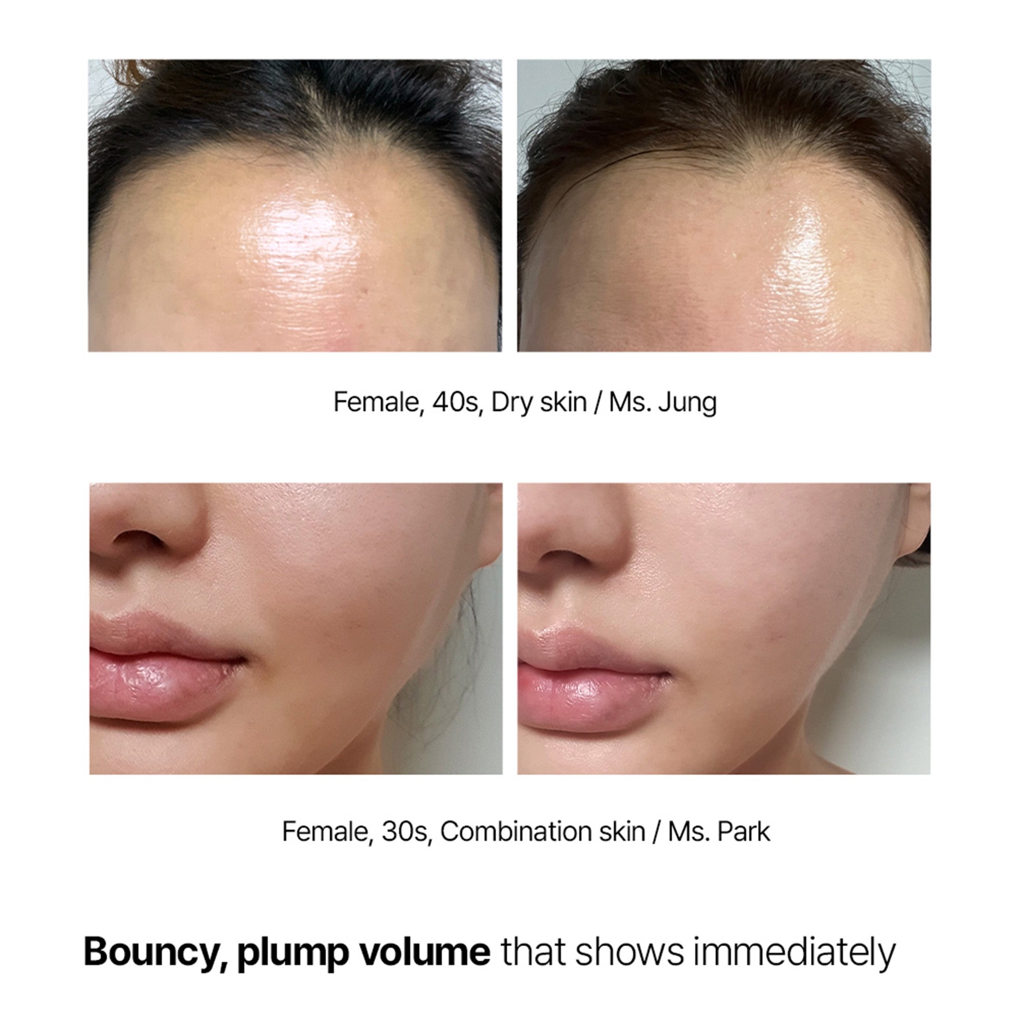 Super Collagen Booster Bubble Serum – Visible Firmness & Glow in 2 Weeks