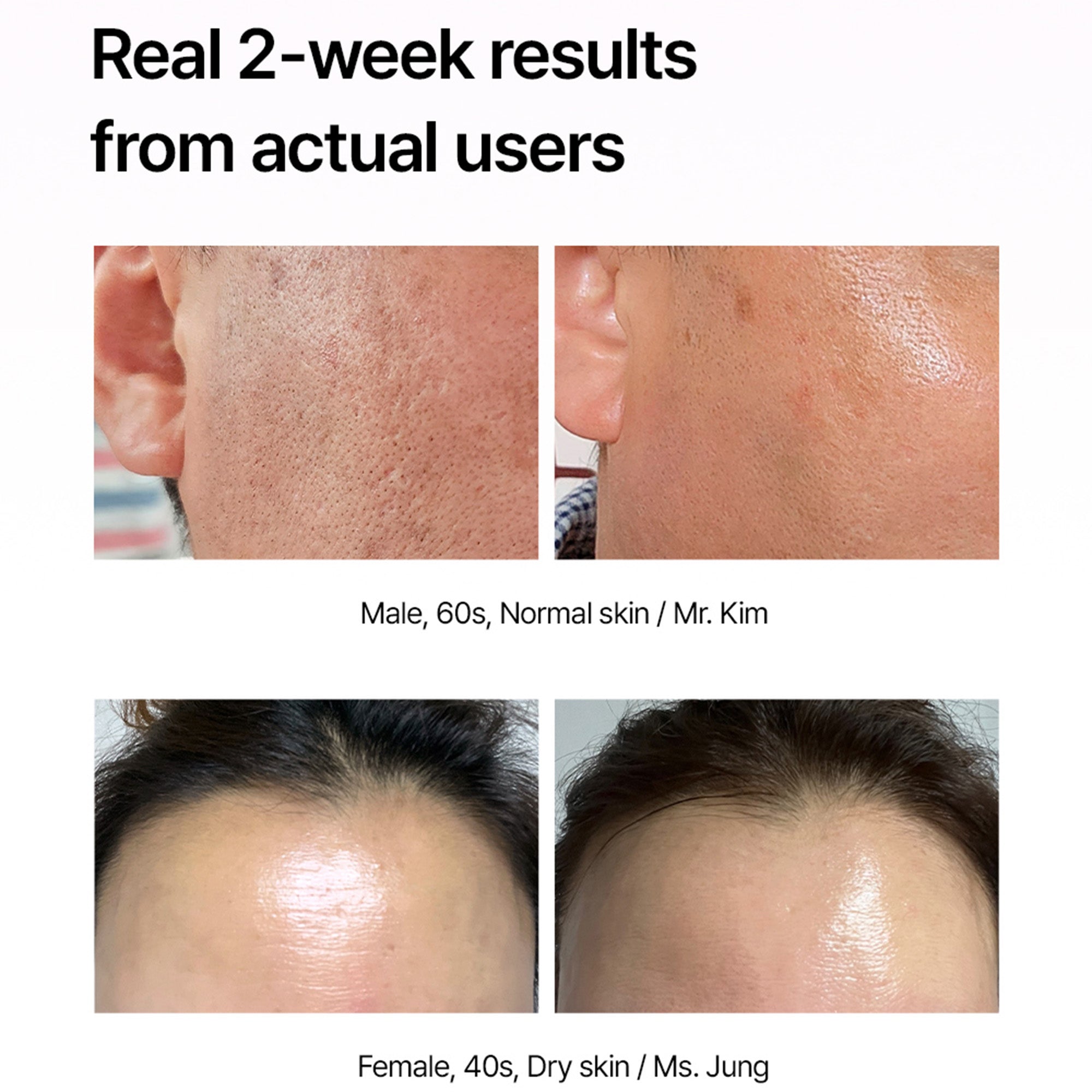 Super Collagen Booster Bubble Serum – Visible Firmness & Glow in 2 Weeks
