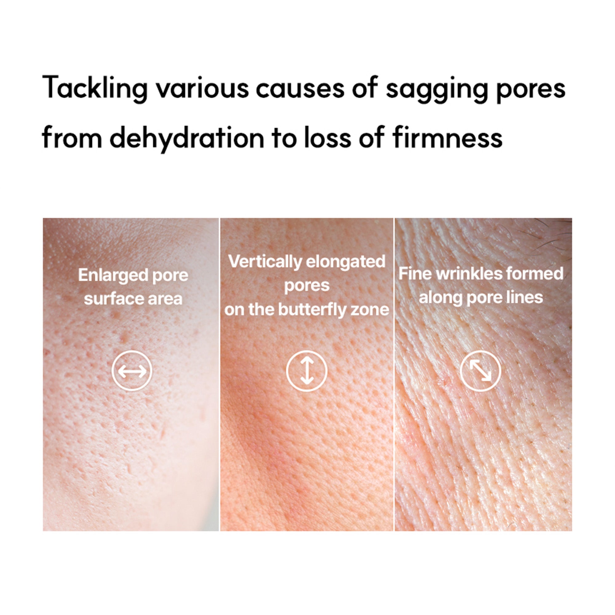 Botulcare Pore Lifting Ampoule – Pore Tightening & Wrinkle Lifting Serum for Sagging Pores & Fine Line