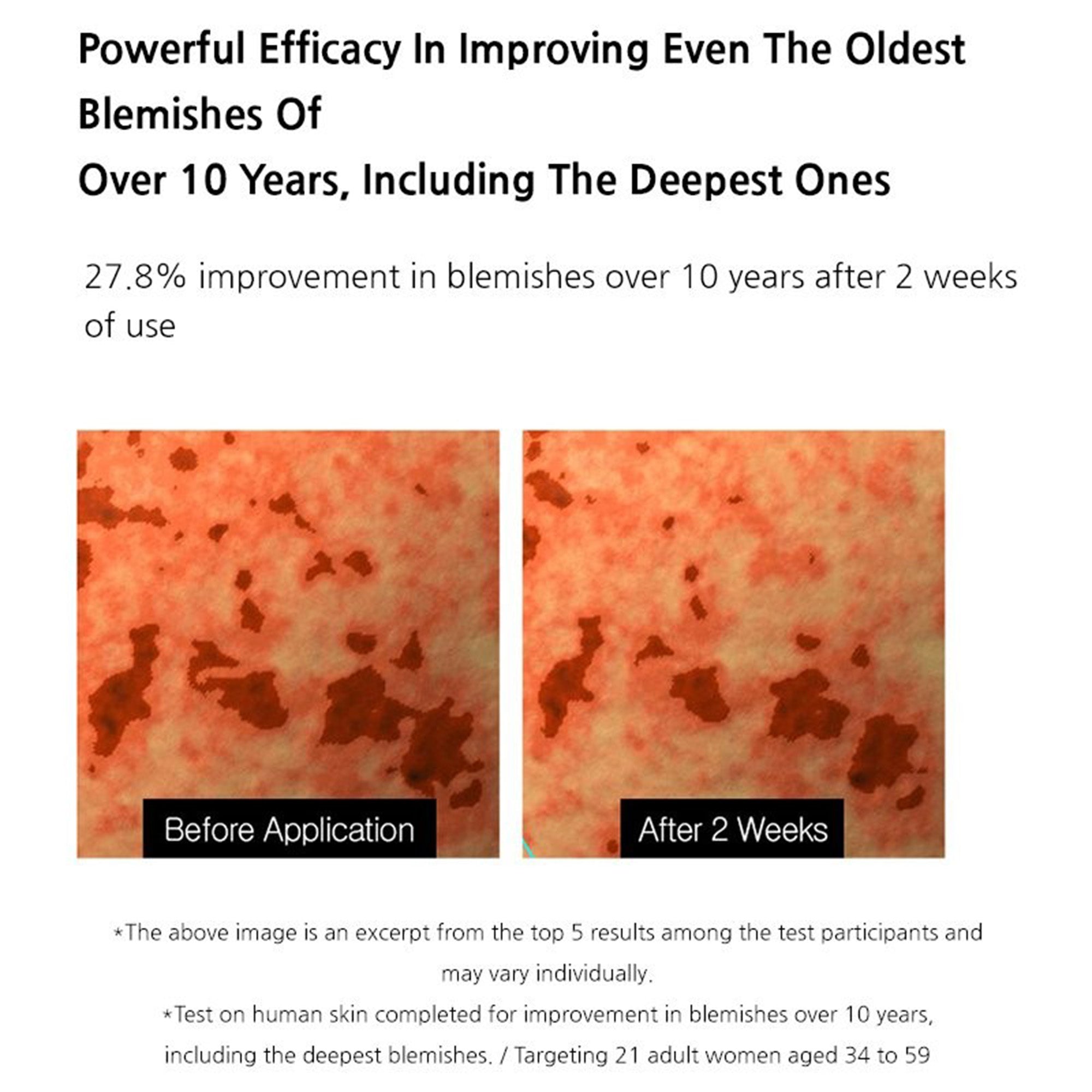 Arocell Milky Drop Ampoule – Brightening & Anti-Aging Korean Serum