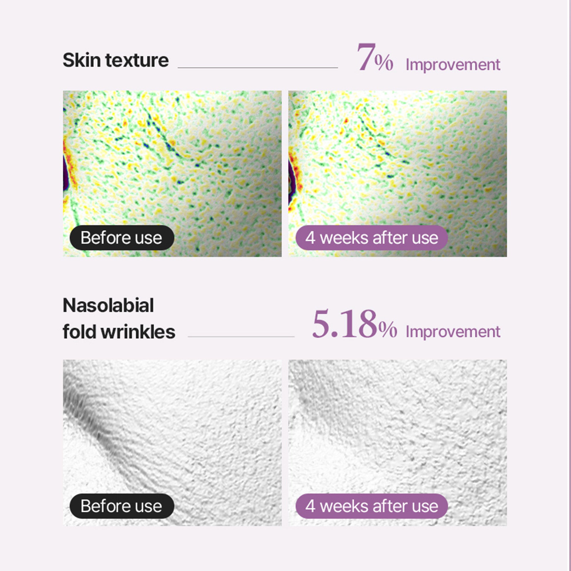 Super Shot Coltra Ampoule – Korean Collagen Spicule Ampoule for Deep Absorption