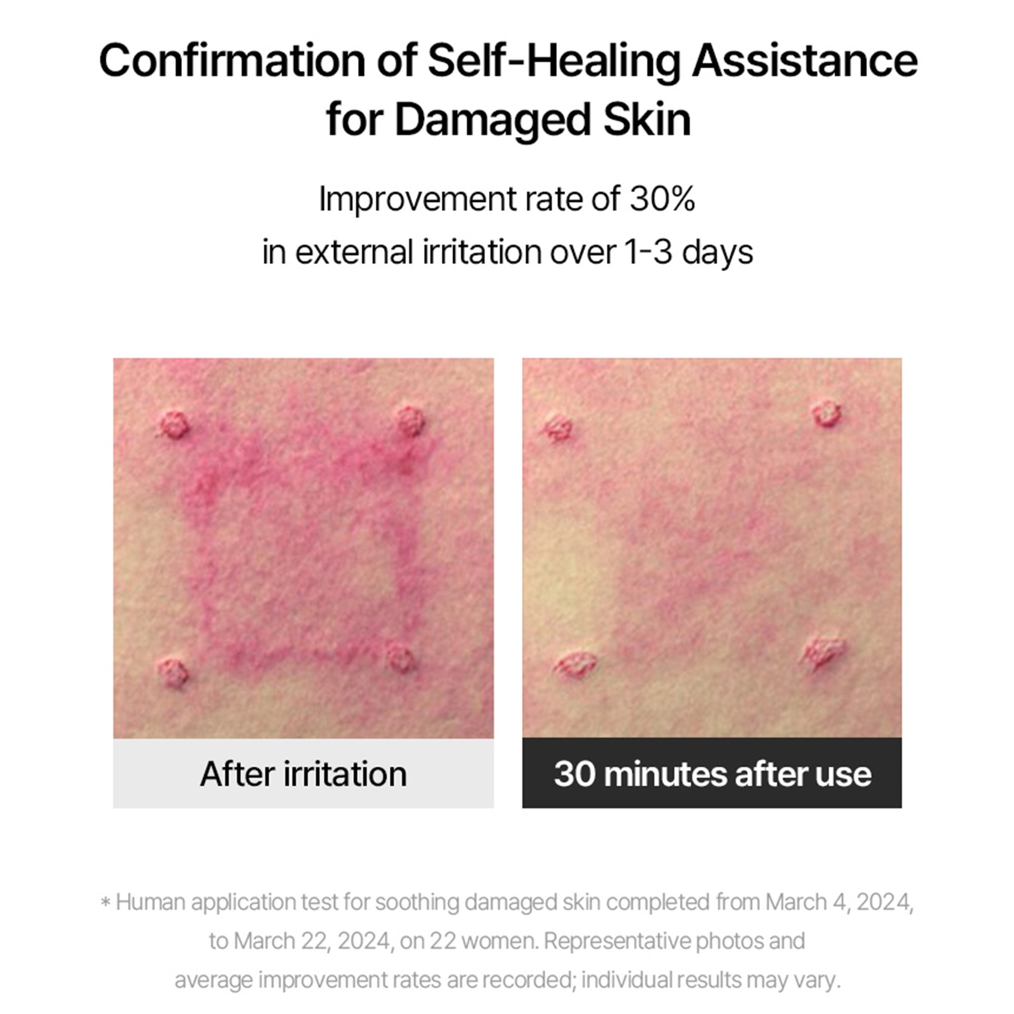 Super Shot Coltra Ampoule – Korean Collagen Spicule Ampoule for Deep Absorption