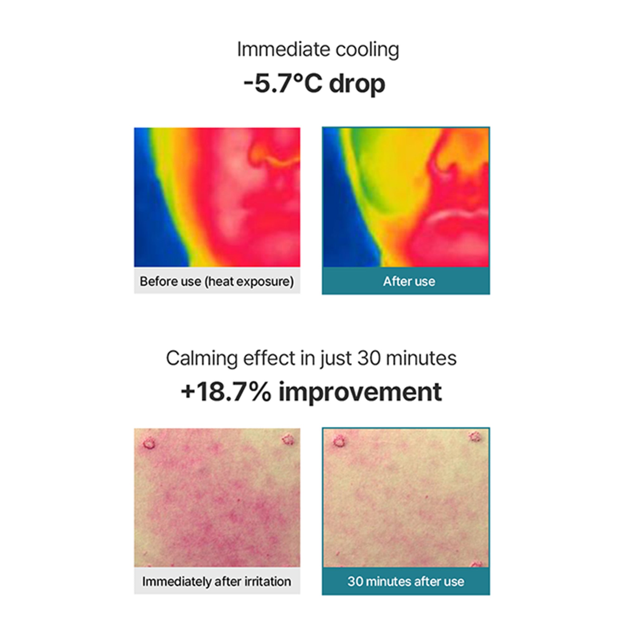 Hyal B5 Soothing Pads – Cooling Relief Jelly Pads with Hyaluronic Acid & Panthenol