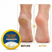Luxury Foot Cream – Intensive Urea & Propolis Repair for Cracked Heels, Dry Calluses, and Peeling Skin