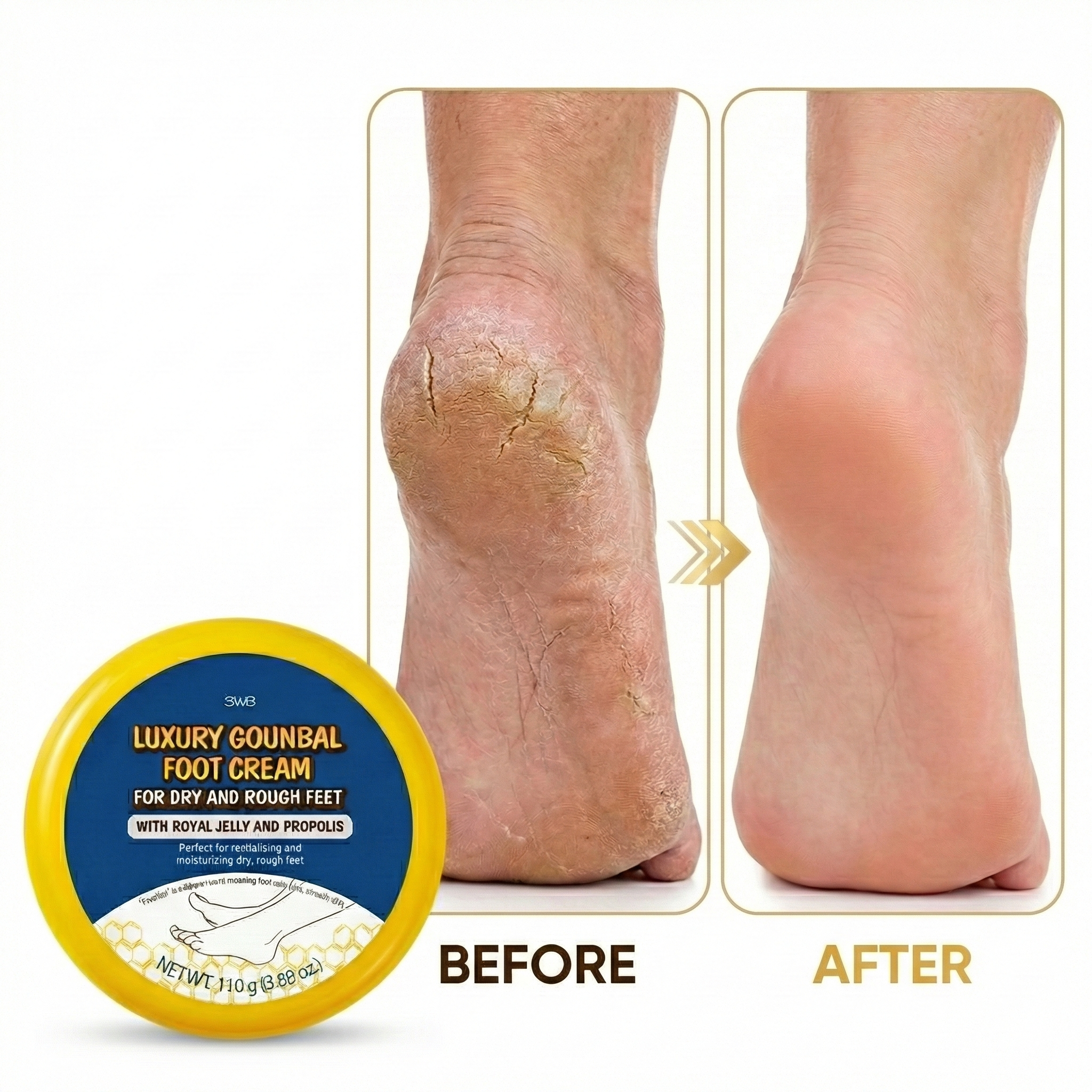 Luxury Foot Cream – Intensive Urea & Propolis Repair for Cracked Heels, Dry Calluses, and Peeling Skin