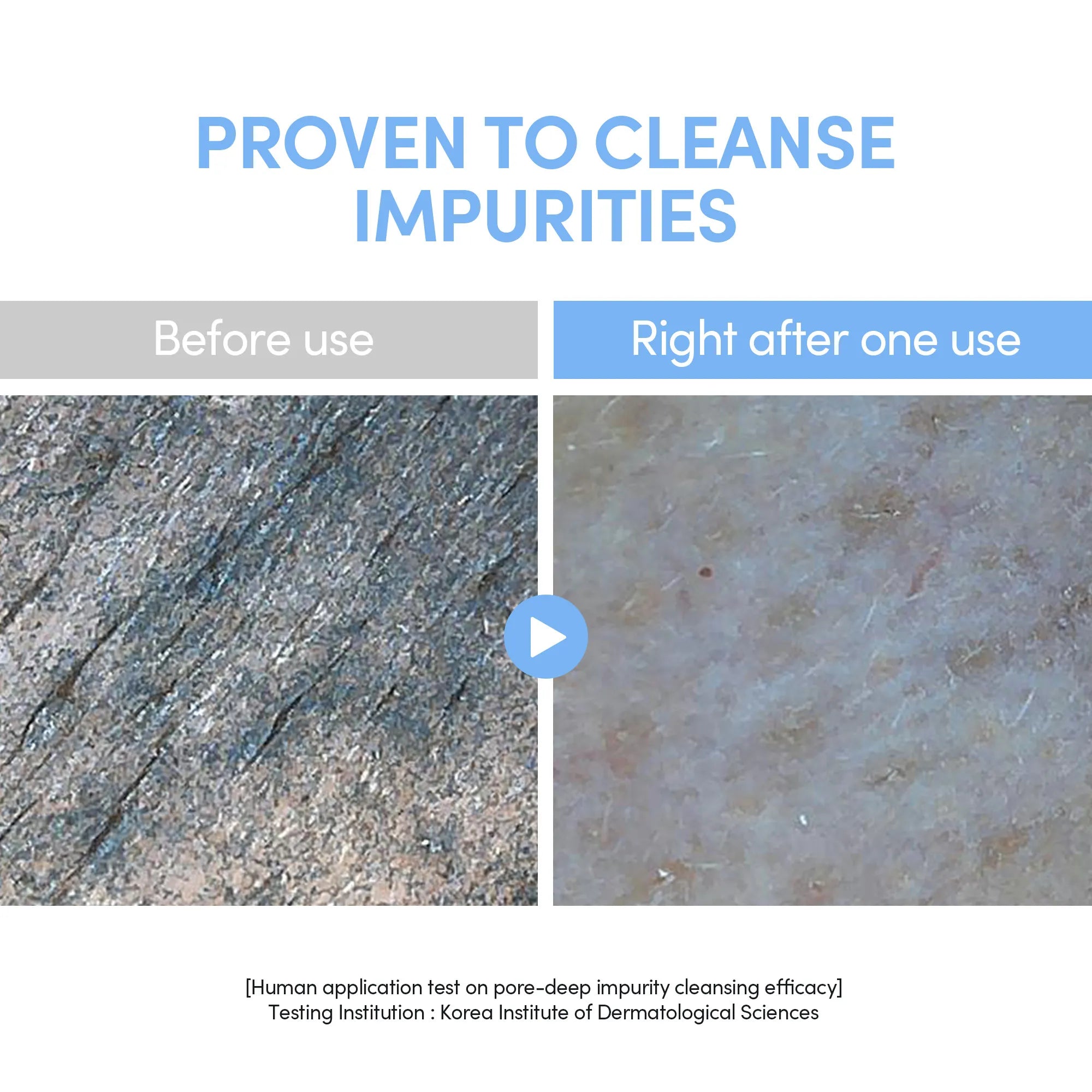 LAGOM Cellup Gel-to-Water Cleanser - Hydrating Morning Cleanser with 85% Skincare Ingredients, Mildly Acidic pH for Sensitive Skin (170ml / 5.74 fl.oz), before and after result.
