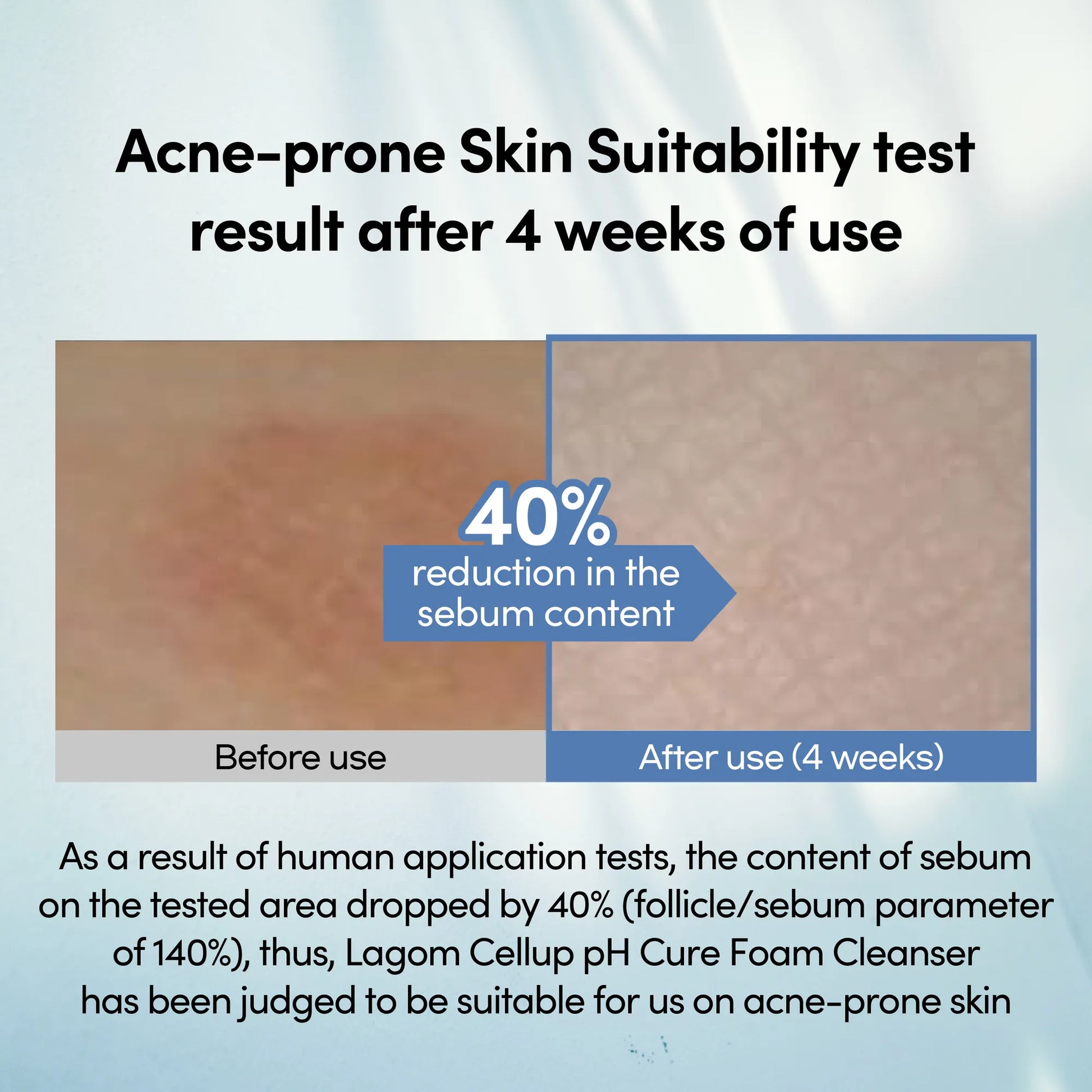 LAGOM Cellup pH Cure Foam Cleanser - Low pH Face Wash for Sensitive & Acne-Prone Skin, Mineral Salt Soothing Formula, Zero Irritation (120ml / 4.05 fl.oz) product view.