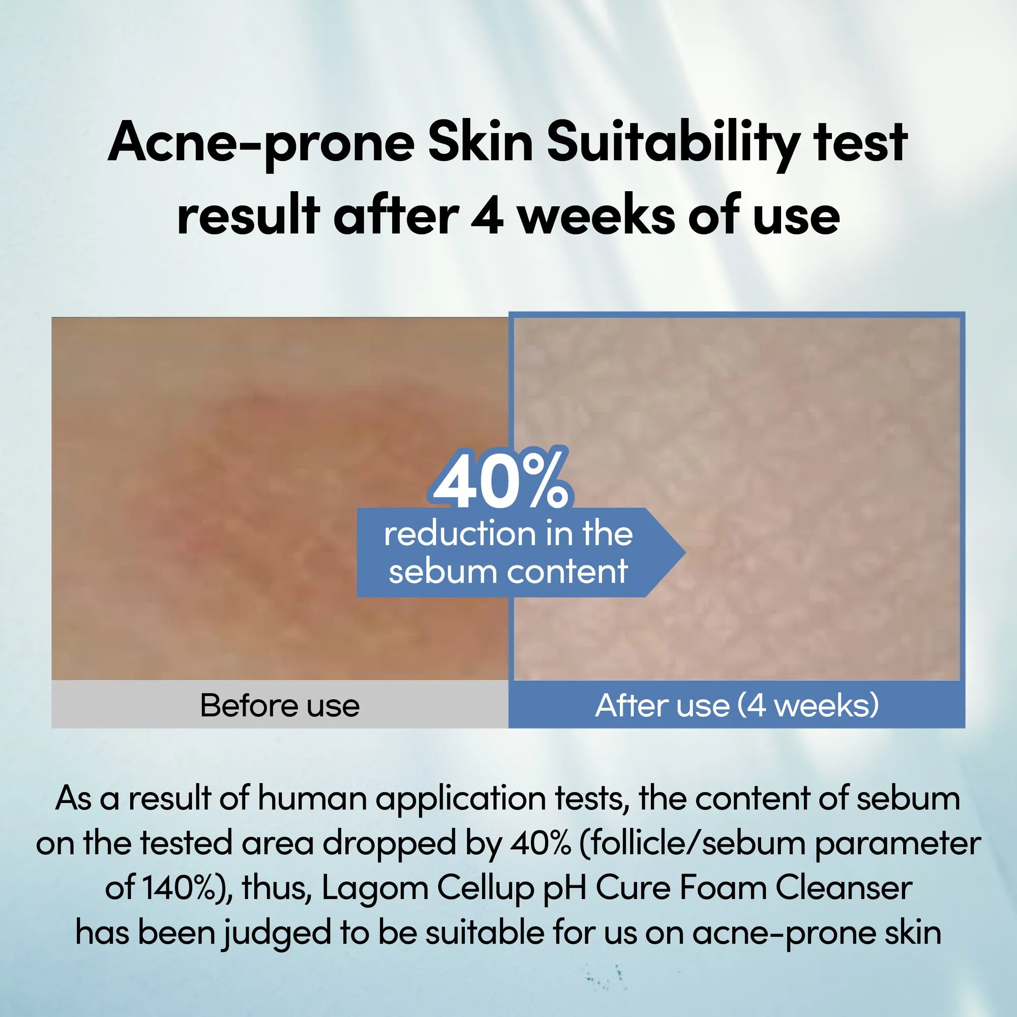 LAGOM Cellup pH Cure Foam Cleanser - Low pH Face Wash for Sensitive & Acne-Prone Skin, Mineral Salt Soothing Formula, Zero Irritation (120ml / 4.05 fl.oz) product view.