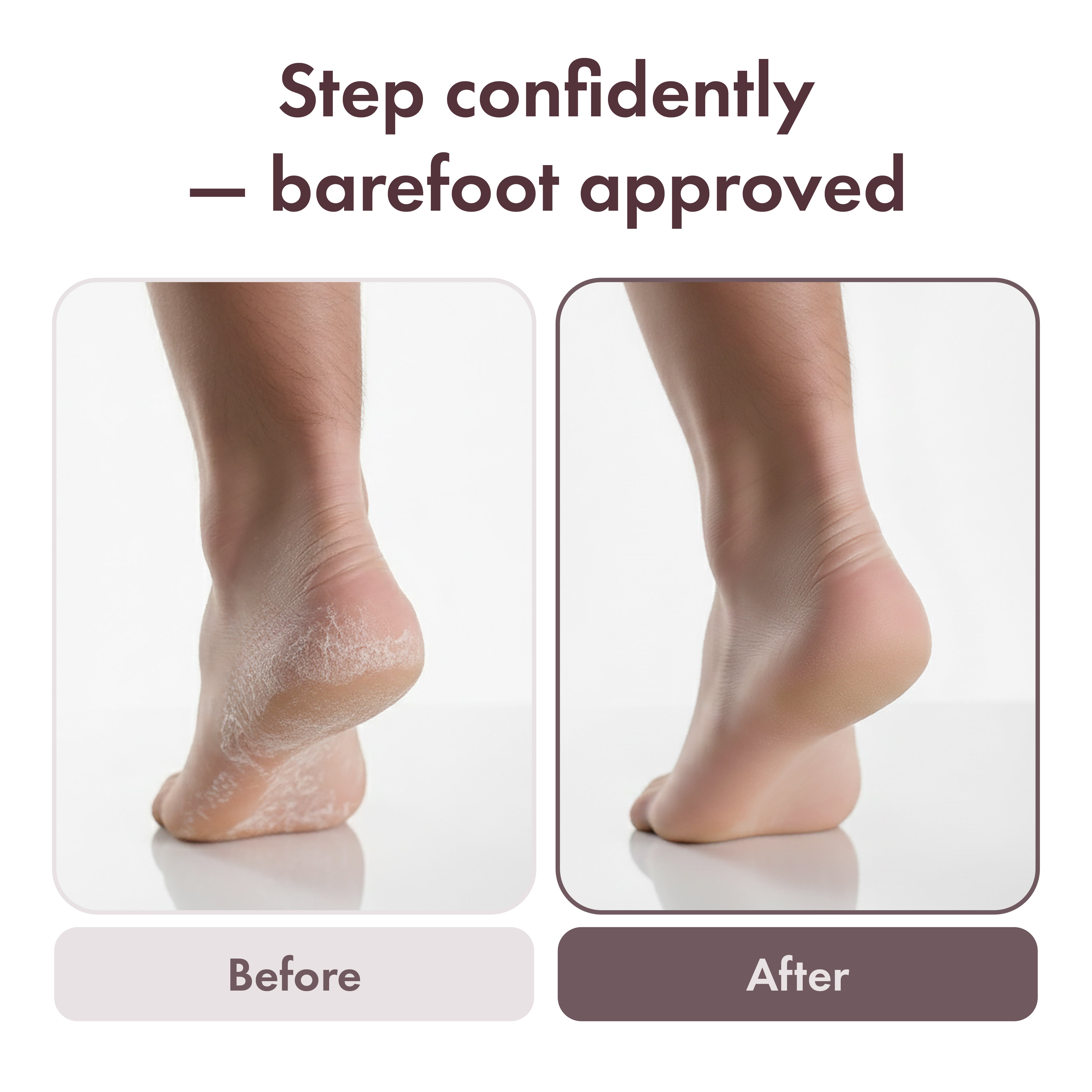 MAVIE Electric Foot File & Callus Remover – Cordless Professional Pedicure Tool with 3 Speeds & Dual Rollers (IPX7 Waterproof)